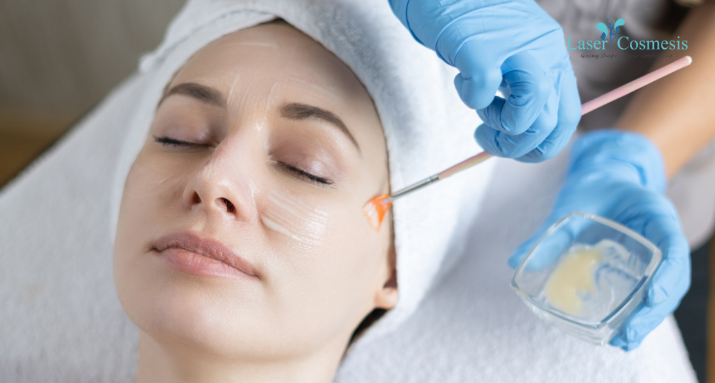  chemical peels for skin rejuvenation