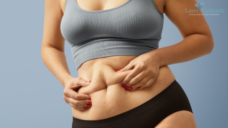 when to consider abdominoplasty