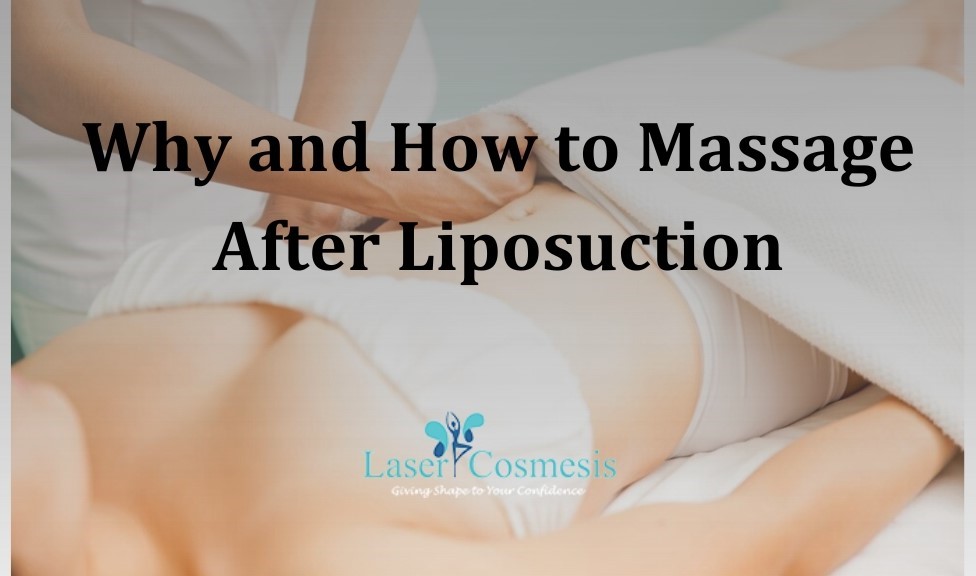 Post-Lipo Skin Tightening