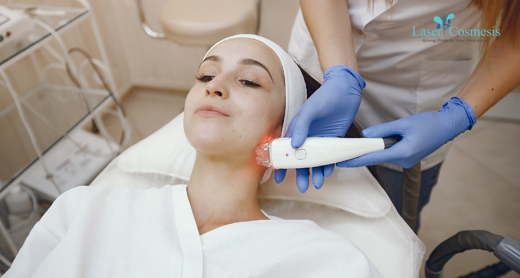 co2 laser treatment