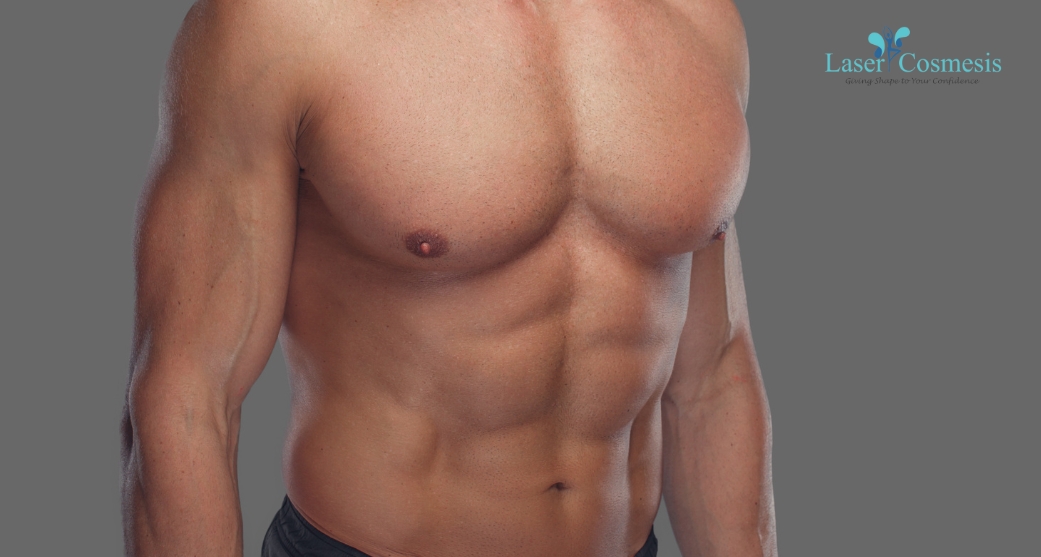 One-Sided Gynecomastia