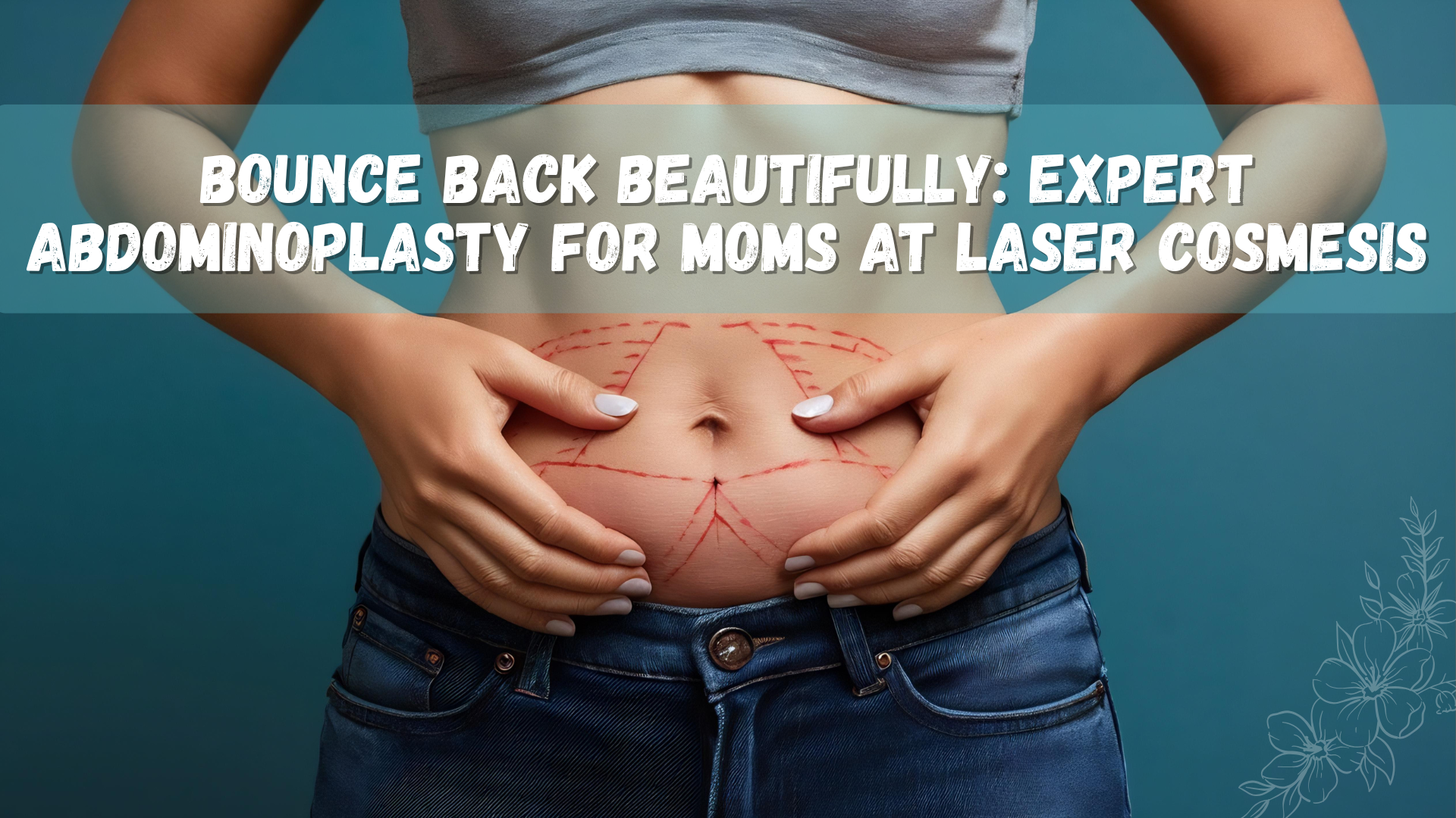 Abdominoplasty surgery in Thane, Mumbai