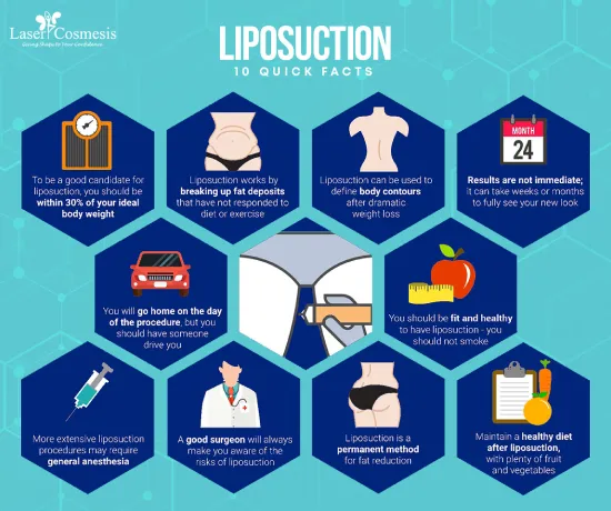 Some quick facts about liposuction surgery in Mumbai and Thane include body contours, being fit and healthy, use of general anesthesia and results that are not immediate, and more.