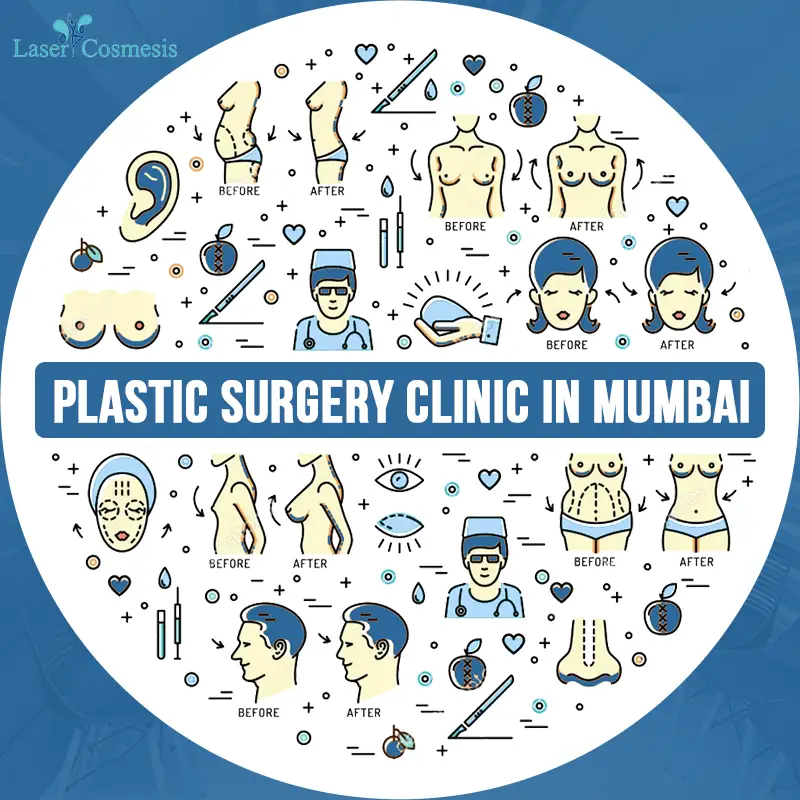 Best Plastic Surgery Clinic in Mumbai: Laser Cosmesis provides the best cosmetic and plastic surgeries and helps you to achieve your dream personality.